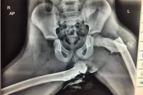 This x-ray shows why you should never rest your feet on the dashboard